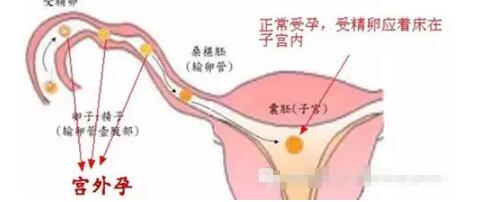 女人抽烟跟性有关系吗(漂亮的女人都抽烟) 抽烟的女人就是坏女人!