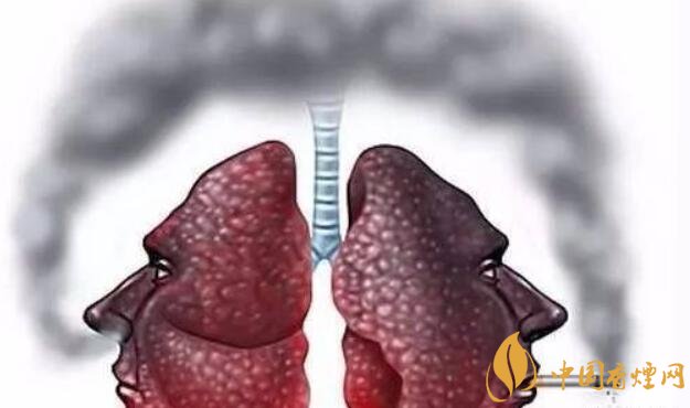 吸烟者的肺_吸烟者能完成这3个小测试 说明你肺部情况还挺好