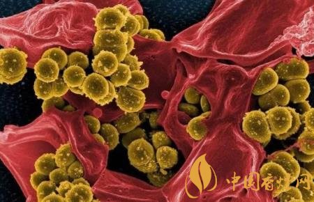 吸烟更容易感染病菌 香烟烟雾促进金黄色葡萄球菌传染