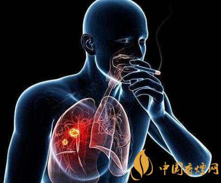 吸烟和肺炎有什么关系 吸烟对于肺炎感染的影响介绍!